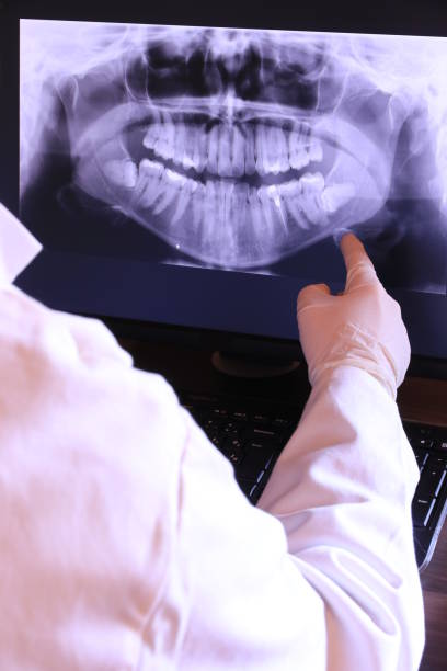 Best Emergency Root Canal Treatment in Irvington, KY