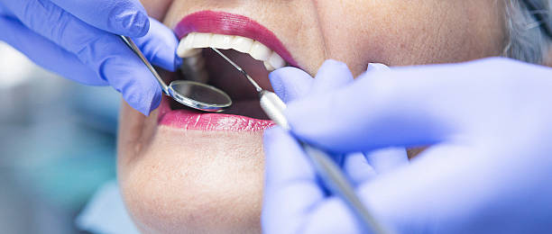 Best Urgent Care for Lost Fillings or Crowns in Irvington, KY
